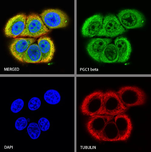 PGC1 beta Recombinant Rabbit mAb (S-1212-146)
