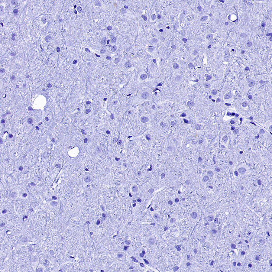 Cytokeratin 1 Recombinant Rabbit mAb (SDT-3225-22)
