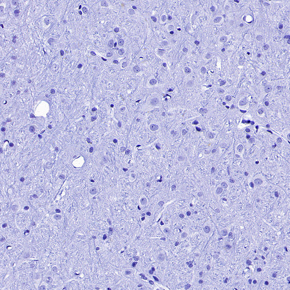 Cytokeratin 1 Recombinant Rabbit mAb (SDT-3225-22)