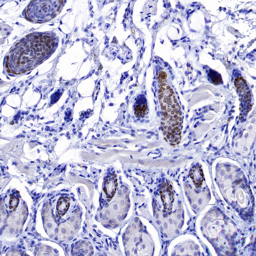 Lhx2/LH2 Recombinant Rabbit mAb (S-3867-28)