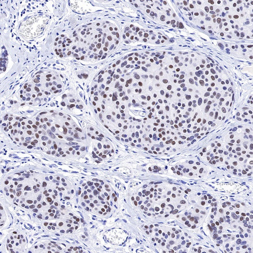 TRPS1 Recombinant Rabbit mAb (S-765-3)