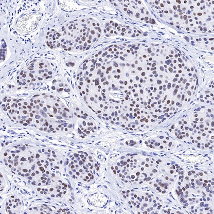 TRPS1 Recombinant Rabbit mAb (S-765-3)