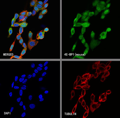 4E-BP1 Recombinant Rabbit mAb (S-4103-65)
