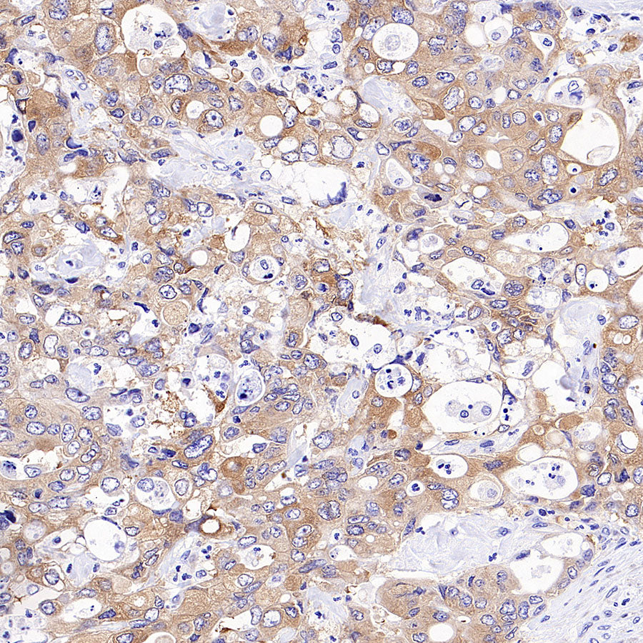 STK39 Recombinant Rabbit mAb (S-3630-15)
