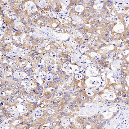 STK39 Recombinant Rabbit mAb (S-3630-15)