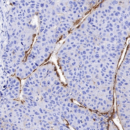 CD36 Recombinant Rabbit mAb,PBS Only (SDT-358-19)