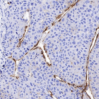 CD36 Recombinant Rabbit mAb,PBS Only (SDT-358-19)