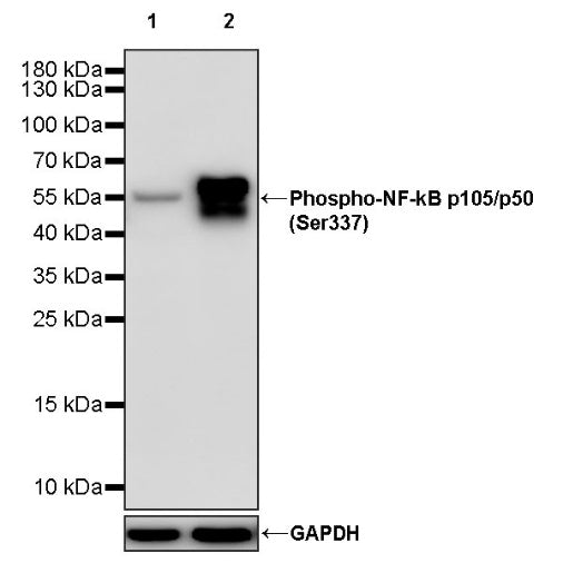 Phospho-NF-kB p105/p50 (Ser337) Recombinant Rabbit mAb (S-1127-19)