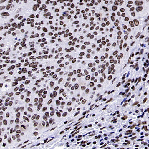 NRF1 Recombinant Rabbit mAb (S-2409-103)