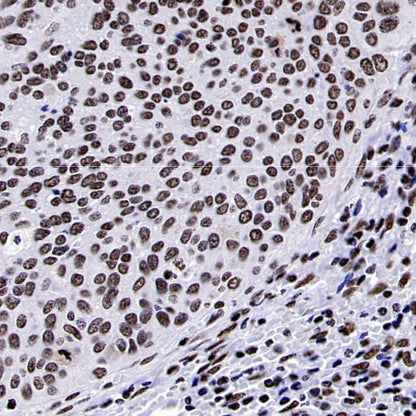NRF1 Recombinant Rabbit mAb (S-2409-103)