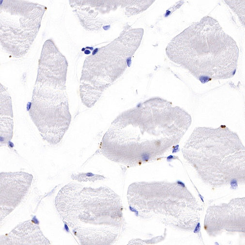 B7-H3 Recombinant Rabbit mAb (SDT-249-26)