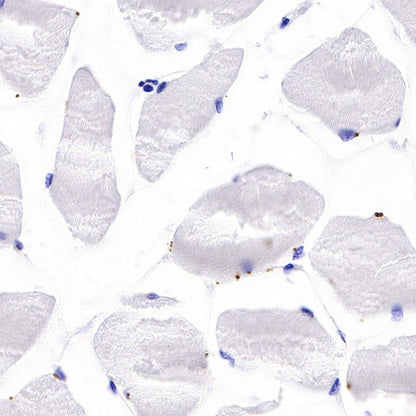 B7-H3 Recombinant Rabbit mAb (SDT-249-26)