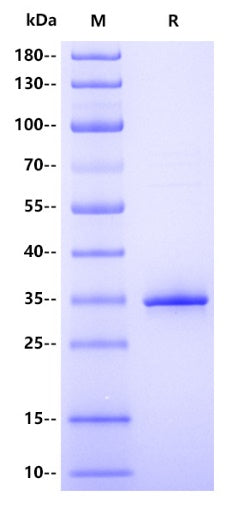 Human ALKBH5 Protein, His tag