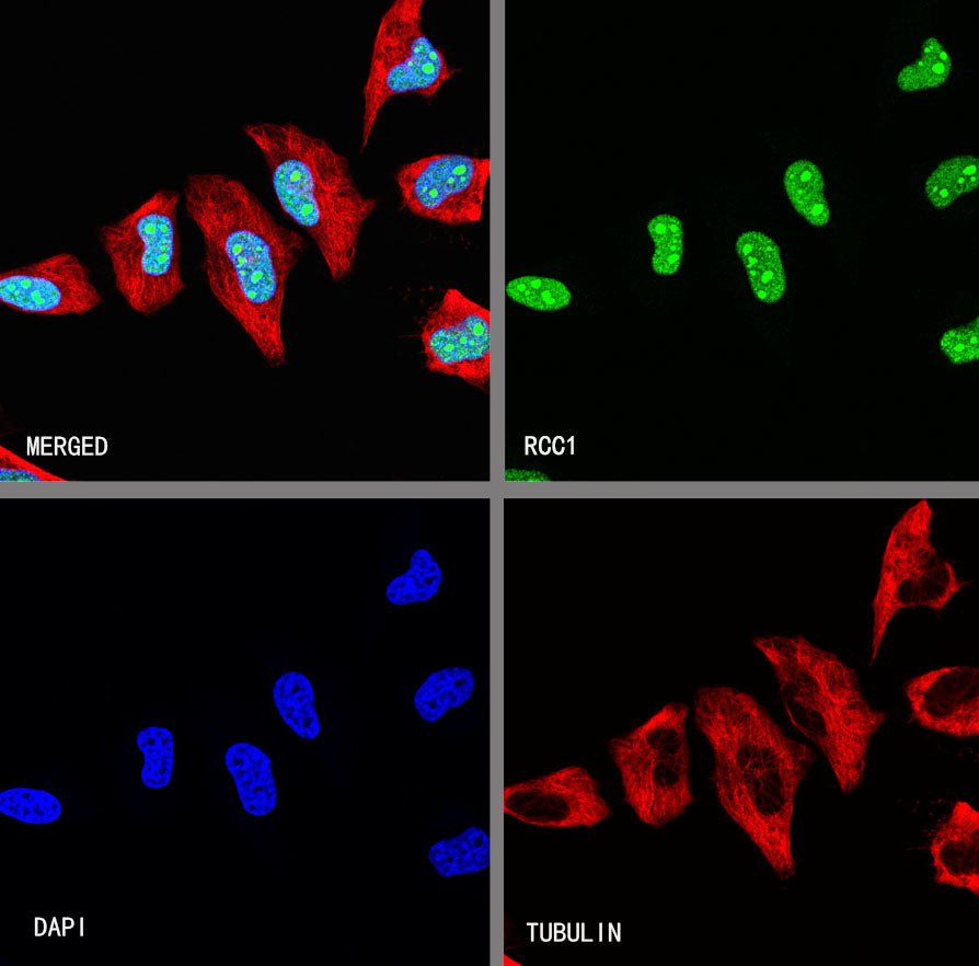 RCC1 Recombinant Rabbit mAb (S-4864)