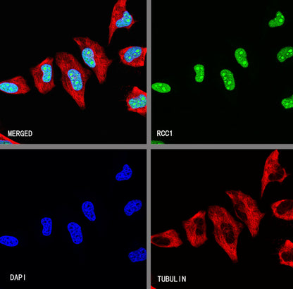 RCC1 Recombinant Rabbit mAb (S-4864)