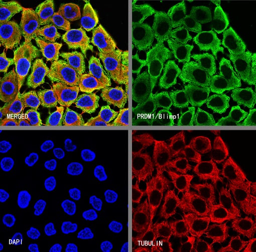 PRDM1/Blimp1 Recombinant Rabbit mAb (S-1972-3)