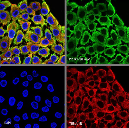 PRDM1/Blimp1 Recombinant Rabbit mAb (S-1972-3)