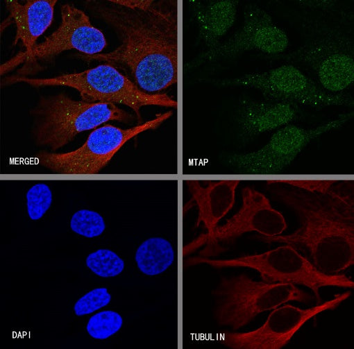 MTAP Recombinant Rabbit mAb (S-R363)