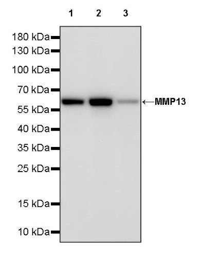 MMP13 Recombinant Rabbit mAb (S-1335-115)