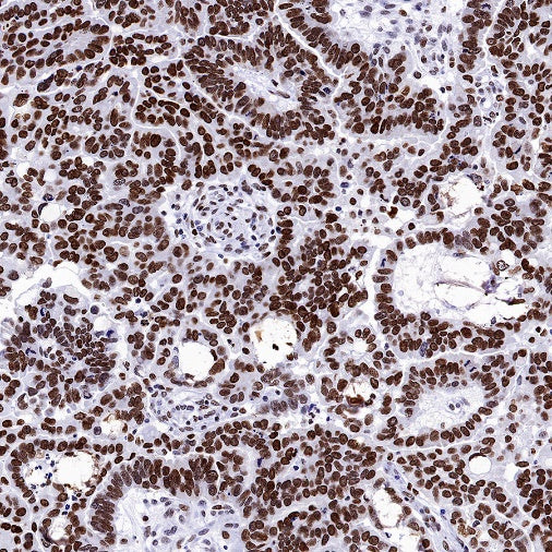 H2AFY Recombinant Rabbit mAb (S-1256-35)