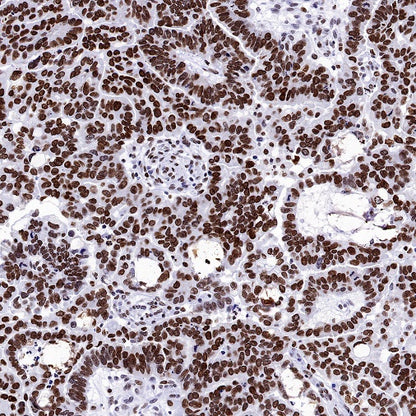 H2AFY Recombinant Rabbit mAb (S-1256-35)