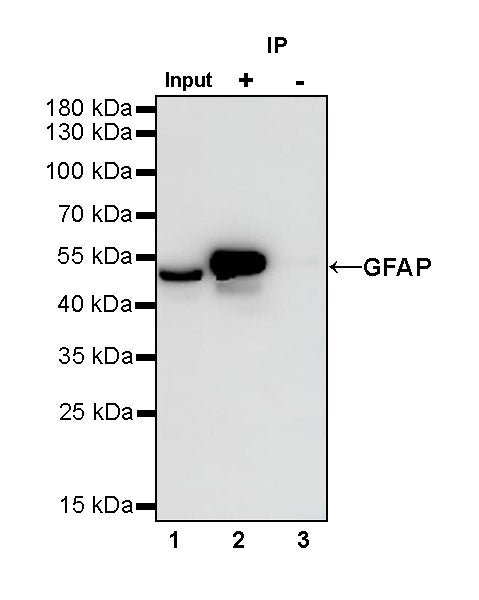 GFAP Recombinant Rabbit mAb (SDT-306-10)