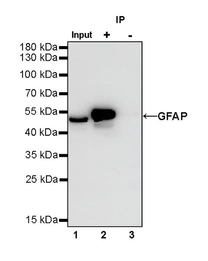 GFAP Recombinant Rabbit mAb (SDT-306-10)