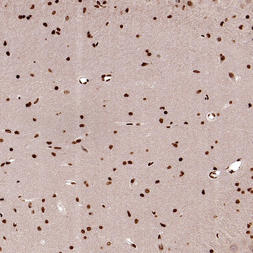 FOXM1 Recombinant Rabbit mAb (S-2529-26)
