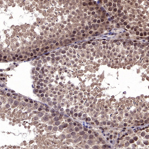 cIAP2 Recombinant Rabbit mAb (S-2483-8)