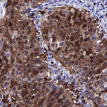 Stathmin 1 Recombinant Rabbit mAb (SDT-383-4)