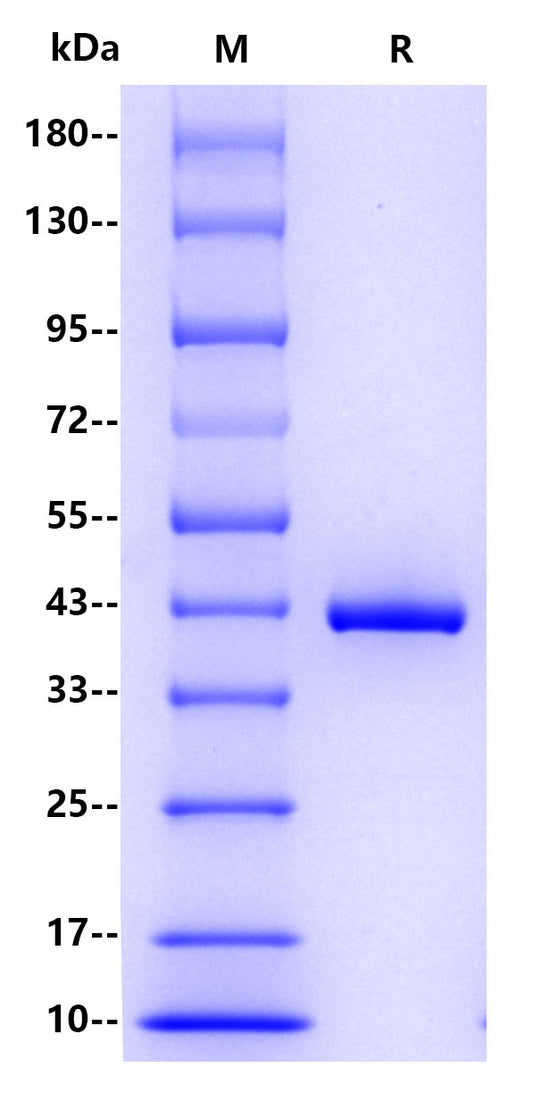 CHI3L1 His Tag Protein, Human