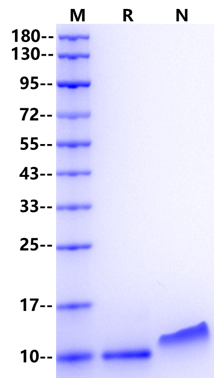 RANTES/CCL5 Protein, Human