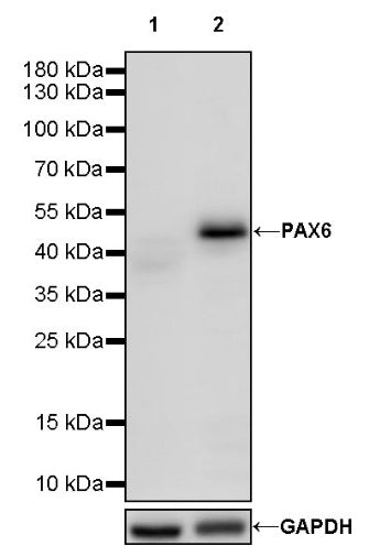 PAX6 Recombinant Rabbit mAb (SDT-1258-145)
