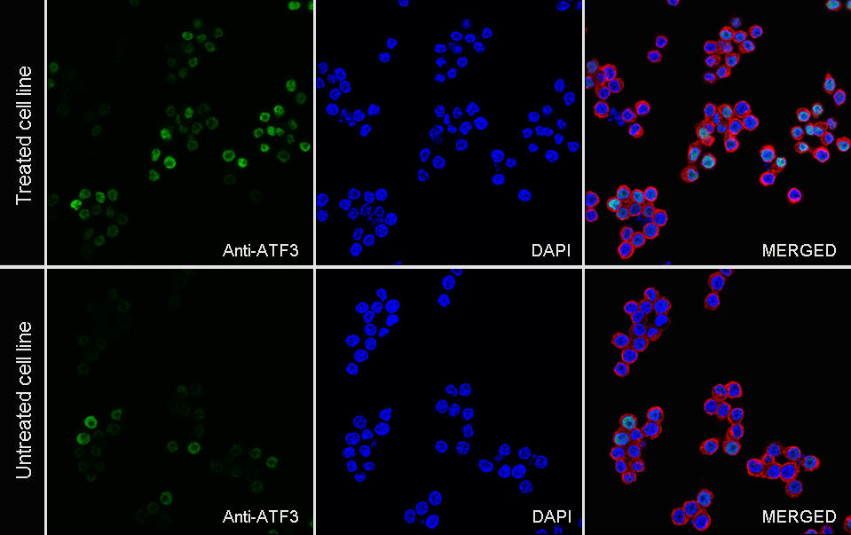 ATF3 Recombinant Rabbit mAb (S-3904)