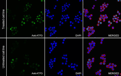 ATF3 Recombinant Rabbit mAb (S-3904)