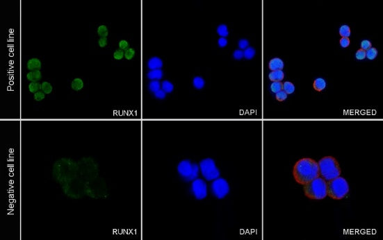 Runx1 Recombinant Rabbit mAb (S-959-64)