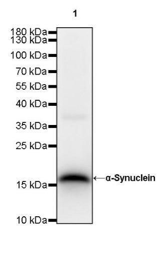 α-Synuclein Recombinant Rabbit mAb (S-441-86)