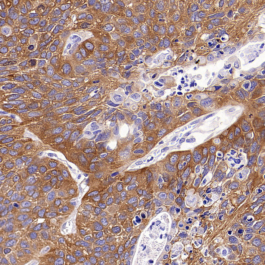 GAB1 Recombinant Rabbit mAb (S-3907-33)