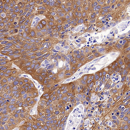 GAB1 Recombinant Rabbit mAb (S-3907-33)