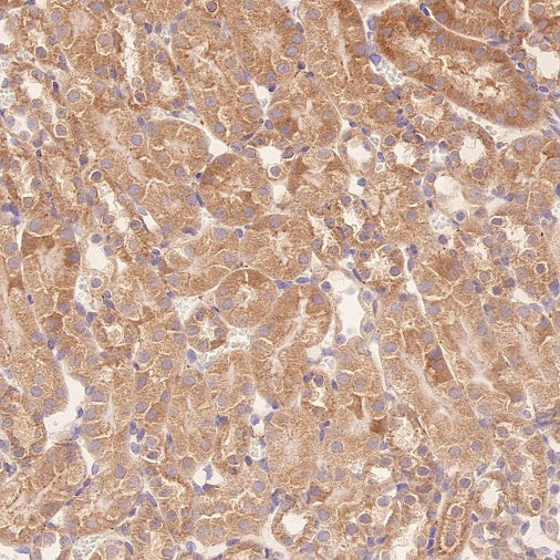TUBA1B Rabbit Polyclonal Antibody