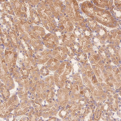 TUBA1B Rabbit Polyclonal Antibody