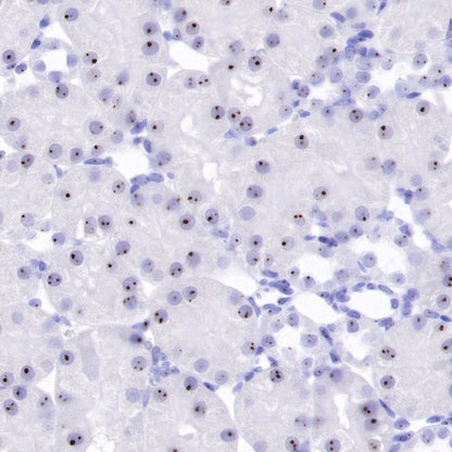 Nucleophosmin/NPM Recombinant Rabbit mAb (S-R231)
