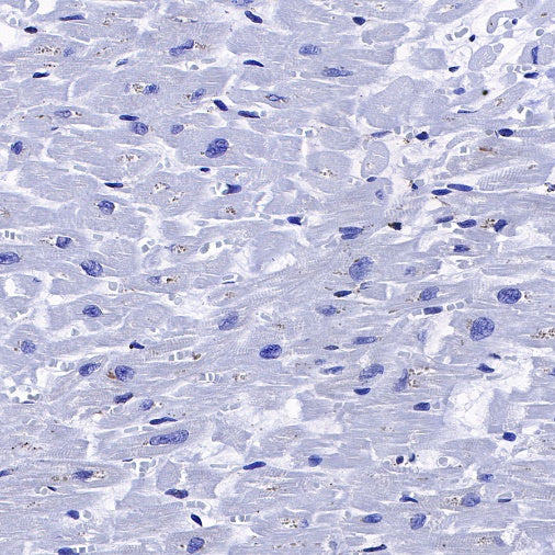 Calreticulin Recombinant Rabbit mAb (S-R353)