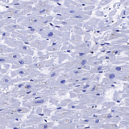 Calreticulin Recombinant Rabbit mAb (S-R353)
