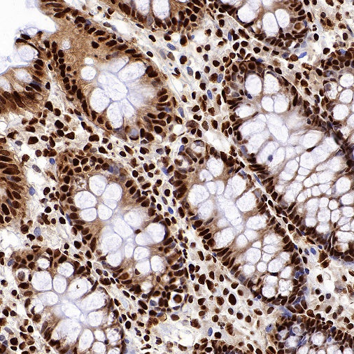 hnRNPK Recombinant Rabbit mAb (S-1645-45)