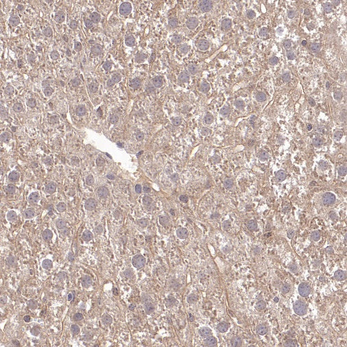 CHMP6/VPS20 Recombinant Rabbit mAb (S-1702-78)