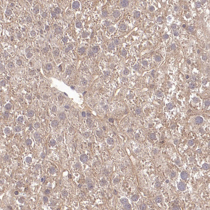CHMP6/VPS20 Recombinant Rabbit mAb (S-1702-78)