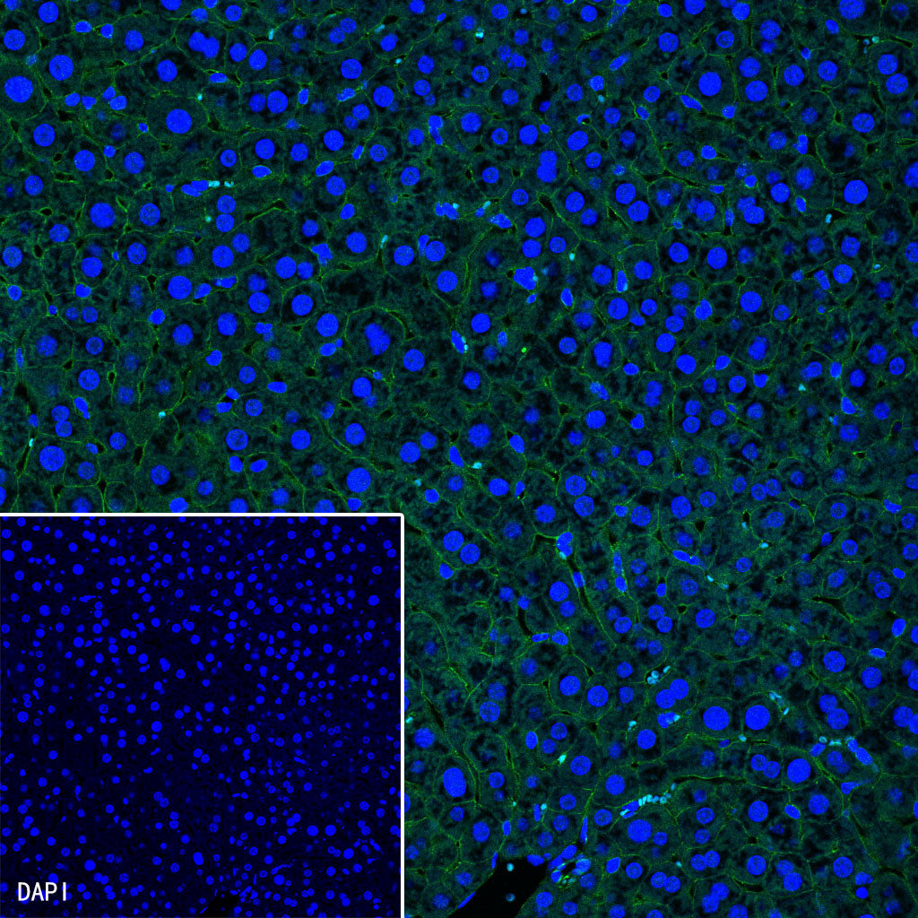 β-Catenin Recombinant Rabbit mAb,PBS Only (SDT-336-23)