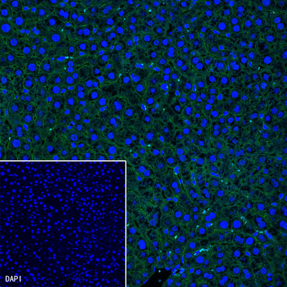 β-Catenin Recombinant Rabbit mAb,PBS Only (SDT-336-23)