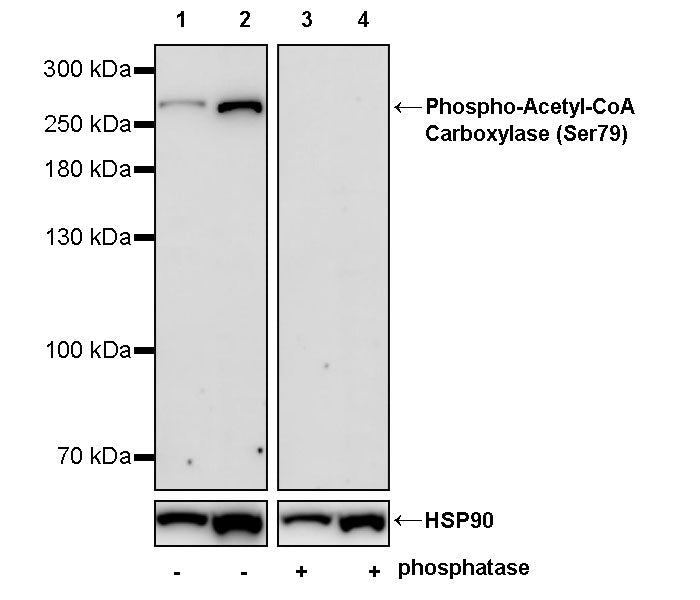 Phospho-Acetyl-CoA Carboxylase (Ser79) Recombinant Rabbit mAb (S-4302)